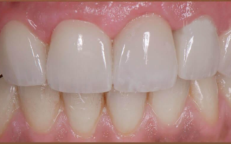 odontologia estetica dental en villa carlos paz