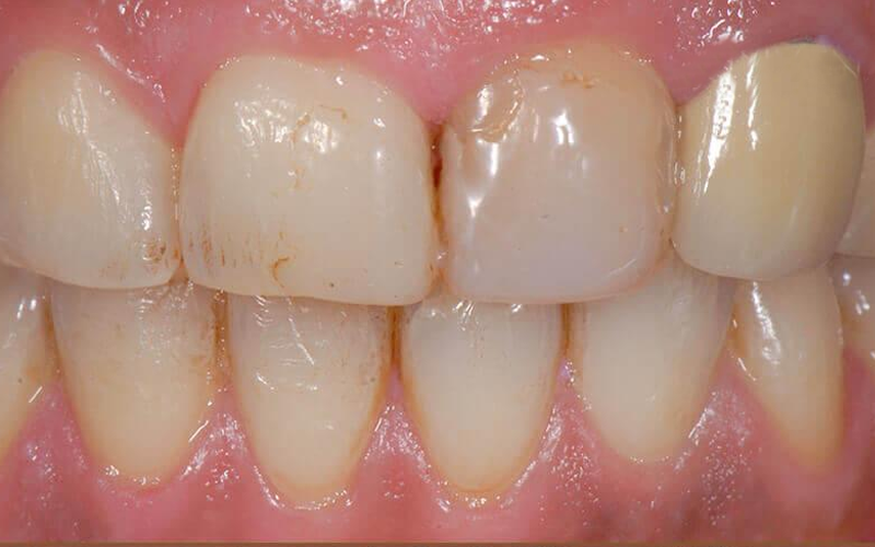 odontologia estetica dental en villa carlos paz