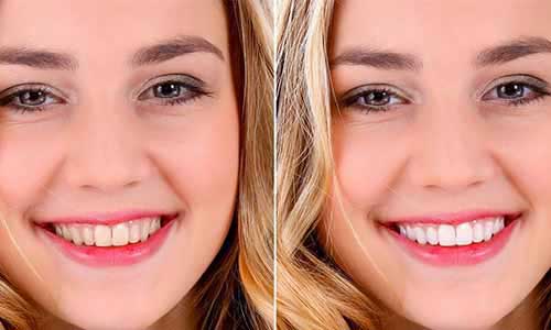 odontologia estetica dental en villa carlos paz